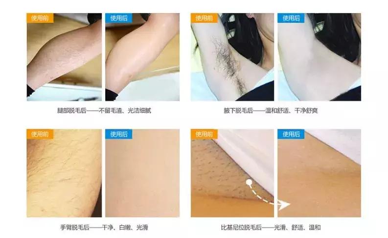 夏天到了，可不能继续当个“毛”女孩！