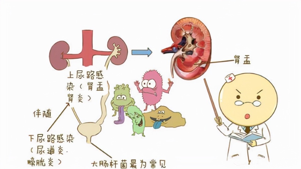 尿路感染的原因是什么引起的儿童,儿童尿路感染的症状及治疗方法