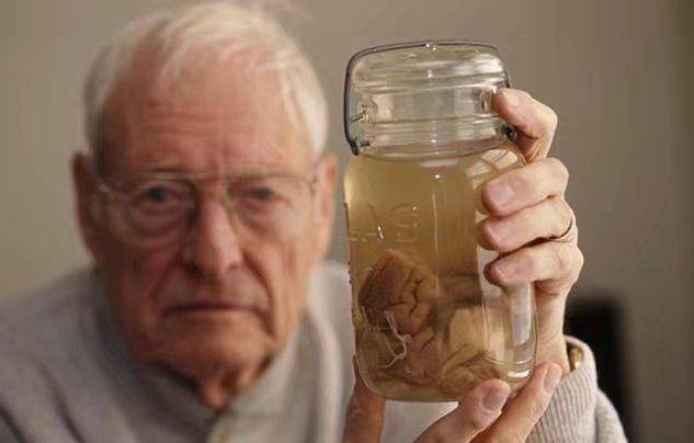 爱因斯坦大脑被偷背后的真相,爱因斯坦大脑被取出全过程