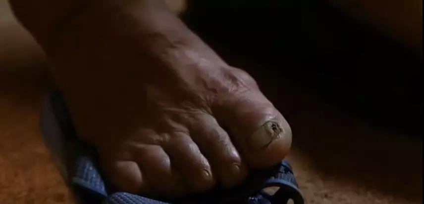 瑙ｅ瘑绁炵灏告瘨,瑙ｅ瘑灏告瘨