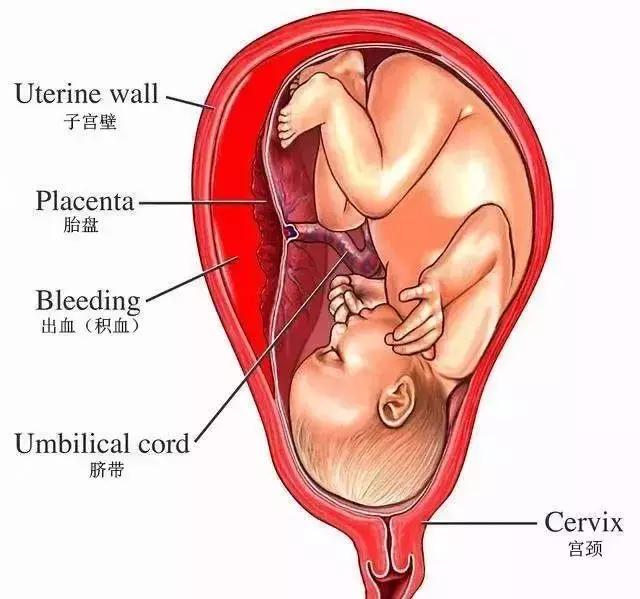 急产的孕妇,急产孕妇注意什么