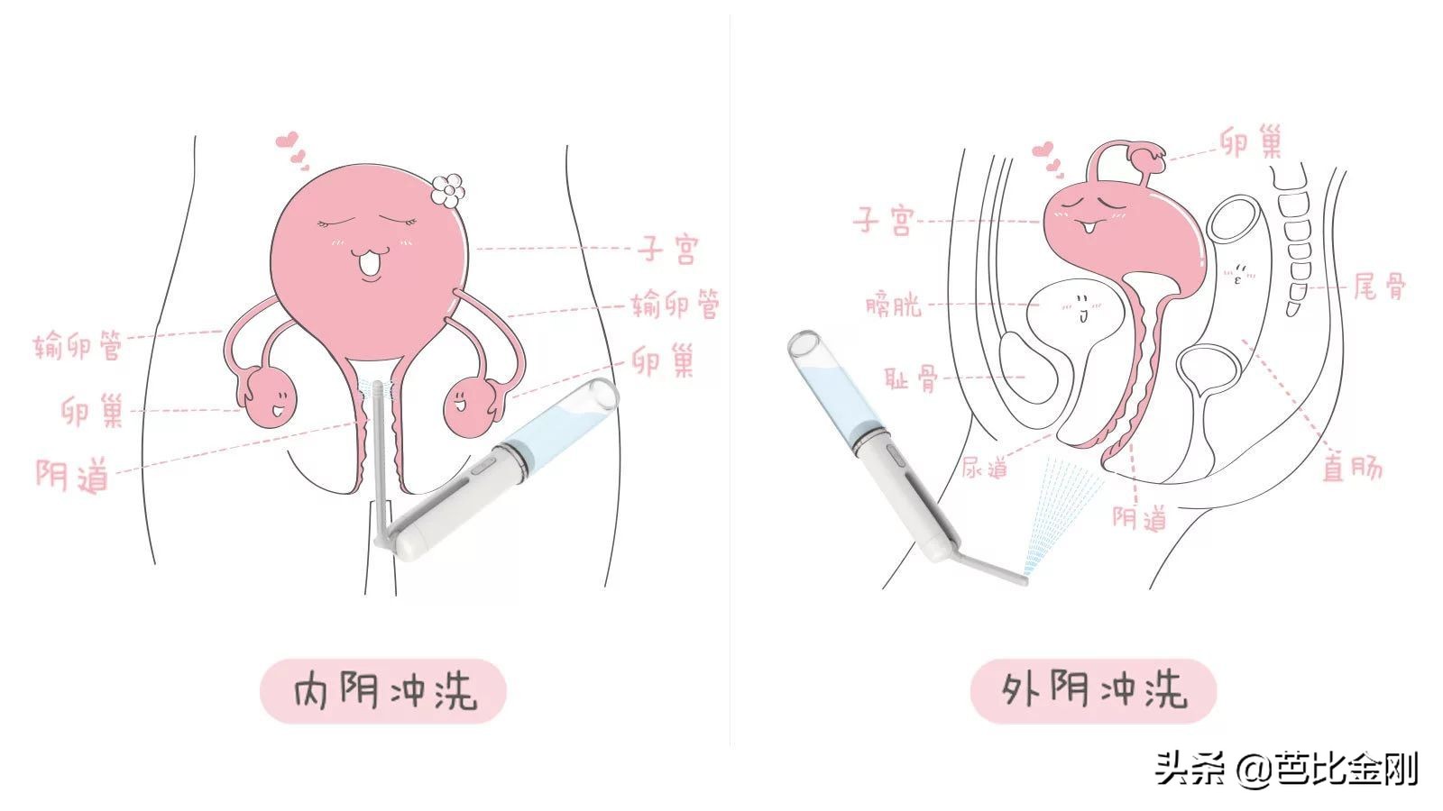 问苍天，*处私**用品竟然有毒？｜最贴身却最伤人