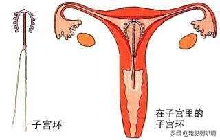 刚出生小宝宝手上拿着一个节育器,婴儿刚出生手里拿着妈妈的节育环