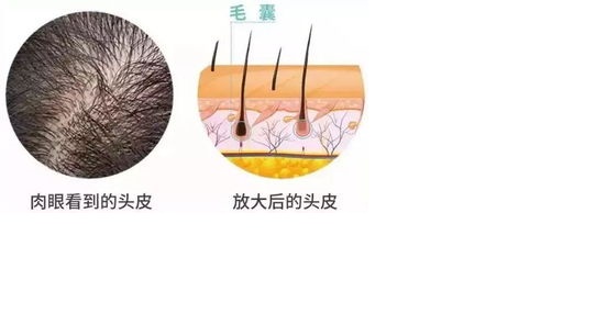 头发为什么越来越细软如何改善,为什么会有特别细软的头发