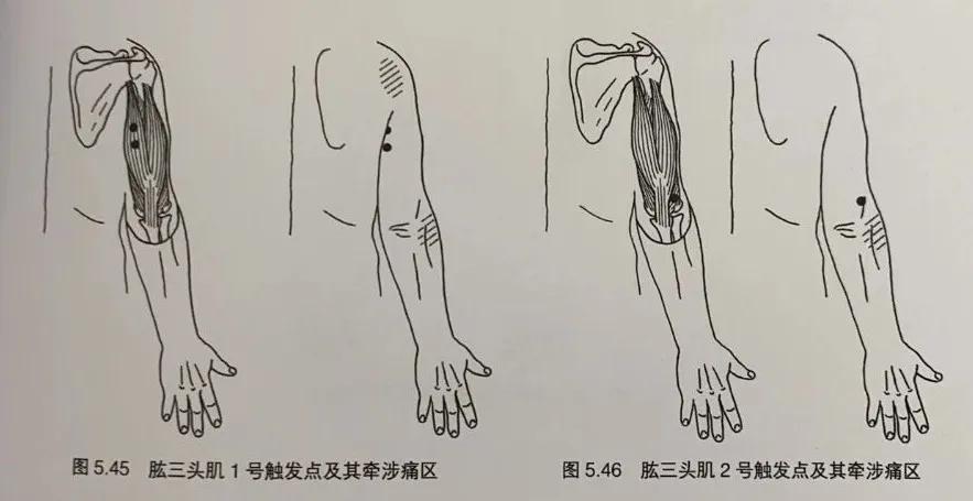 专业解决各种疼痛治疗效果好吗,专业疼痛调理