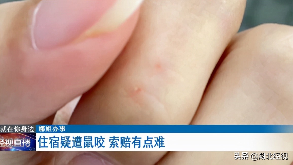 住酒店被耗子咬了一口,住民宿被老鼠咬了