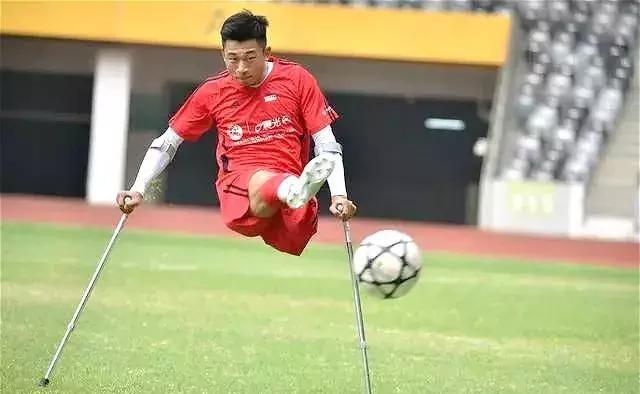 单腿都被截肢后可以用假肢吗,单腿截肢后又双腿截肢