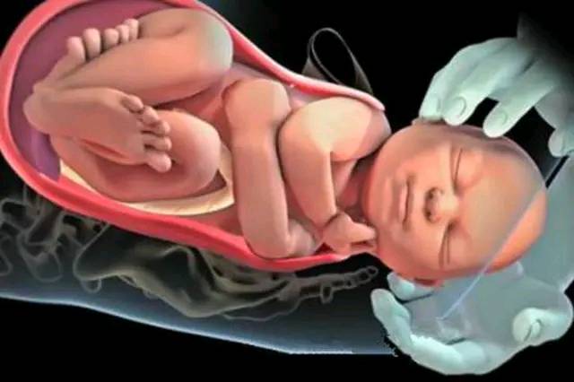 女人顺产除了痛还有什么症状,女人顺产和剖腹产都怎样的疼痛