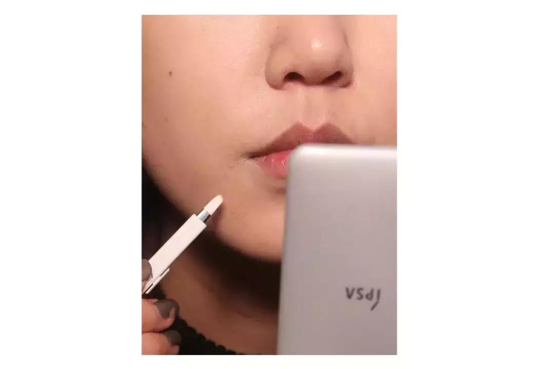 缇庡鐨偆绠＄悊鍖栧,缇庡闄㈠仛鑲岃偆閬憰