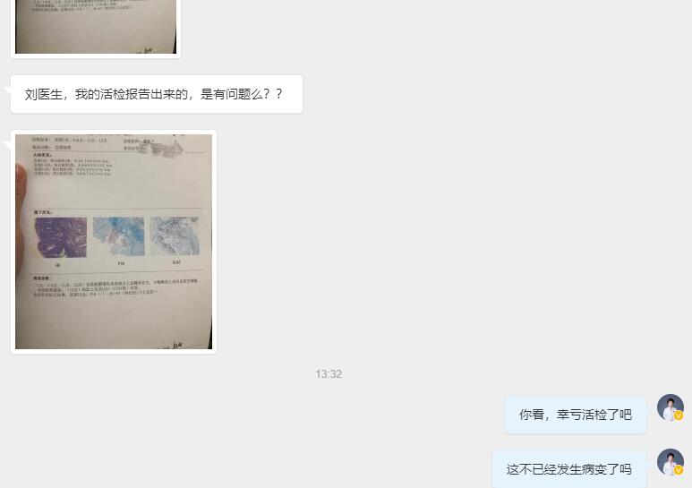 宫颈癌前期活检会是怎么样,宫颈癌一定要活检才能查出来吗