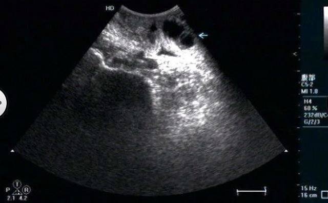 辟谷的意思就是不吃碳水吗,辟谷是什么都不吃么