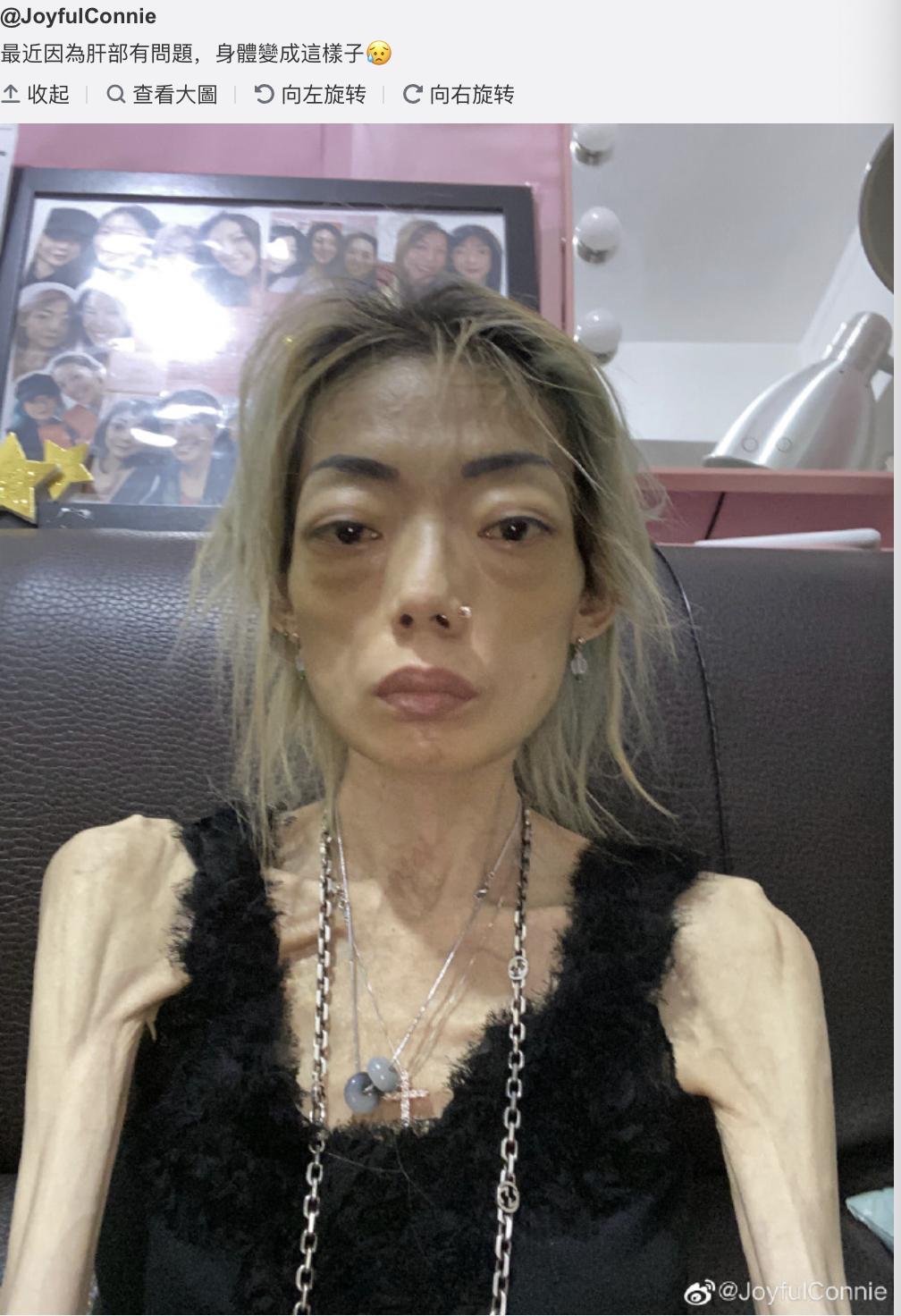 郭永淳前妻罕露脸精神尚可，仍暴瘦如柴，靠拍卖名牌赚钱筹医药费