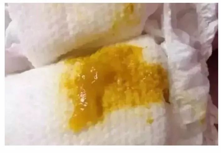 新婴儿大便怎样才是正常的,新生儿宝宝大便怎么判断是否正常