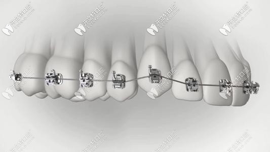 南京整牙哪家医院好多少钱,南京成人隐形整牙多少钱