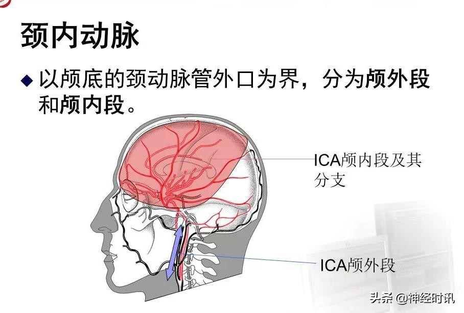 脑动脉解剖学讲解,基底节区脑血管解剖