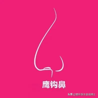 鼻整形如何一步到位,袁博整形医生