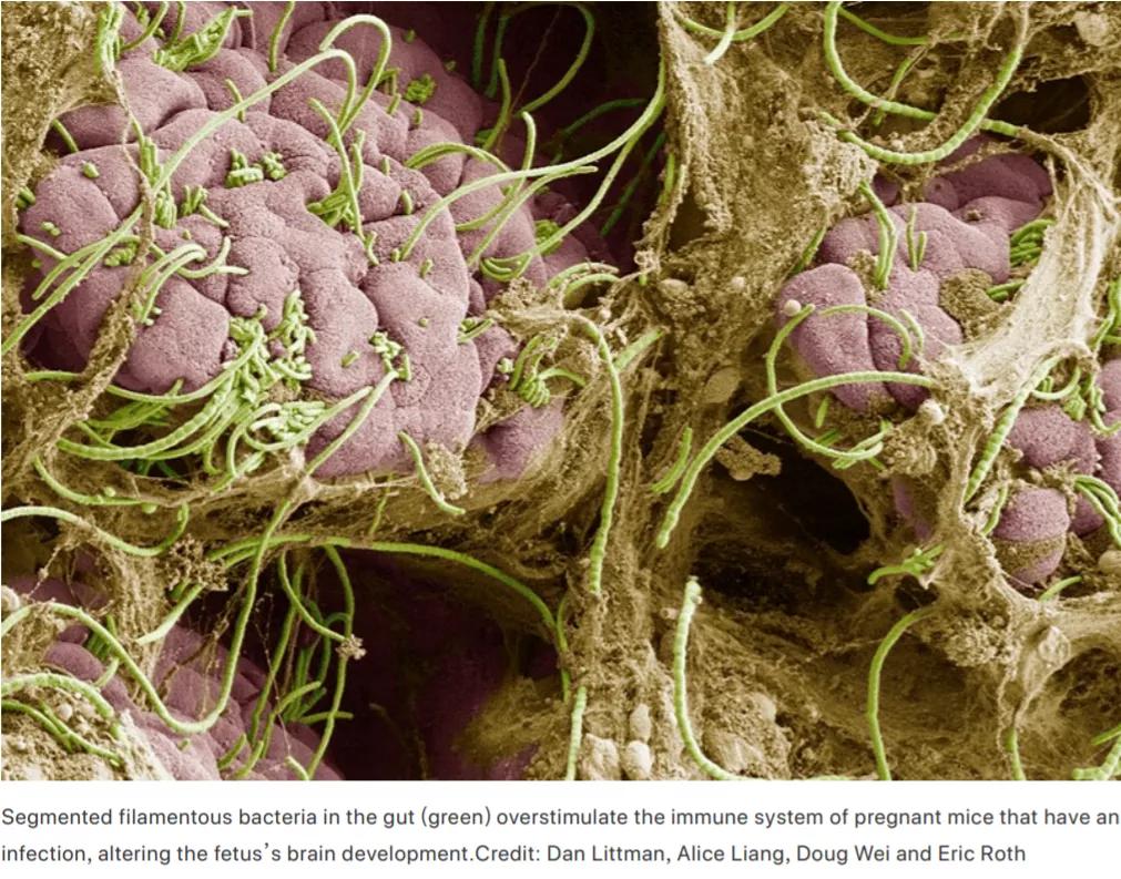 肠道如何让大脑更健康的,肠道控制大脑的方法
