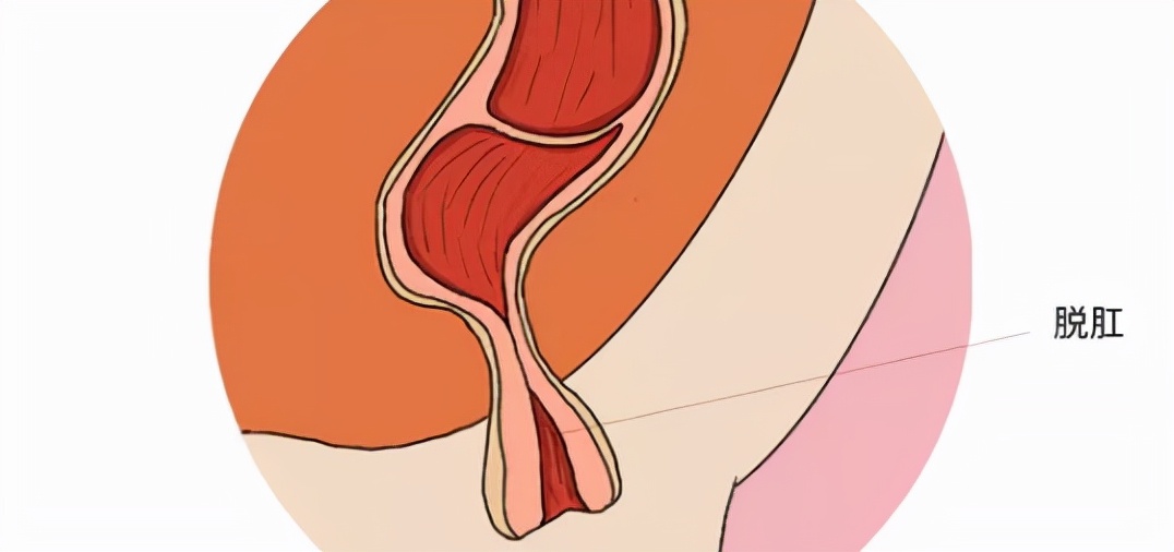 中医绝密配方治脾胃虚弱,治疗脾胃虚弱的中药怎么喝