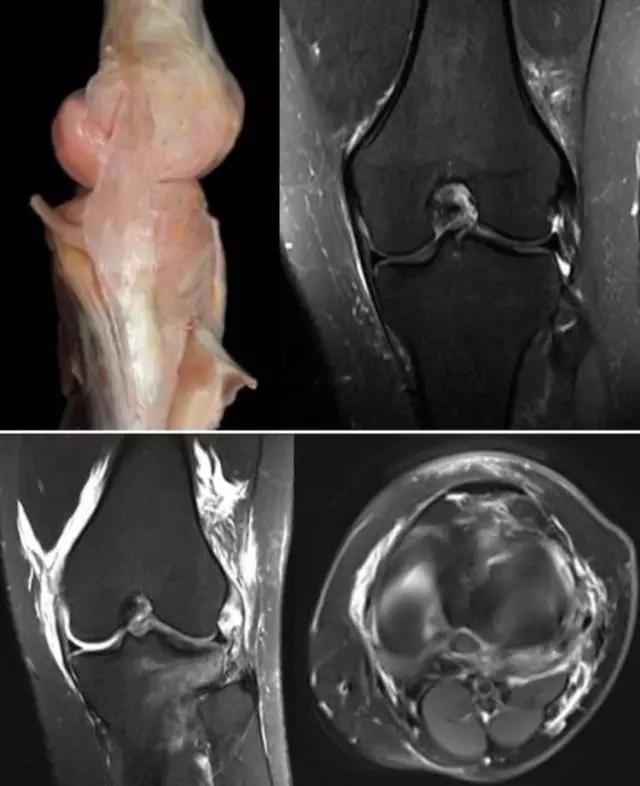 mri临床医师必读电子书,临床医生如何读mri