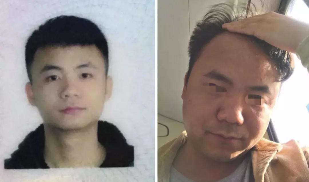 癌症晚期突然张嘴睡觉还能撑多久,癌症晚期24小时睡不着意味什么