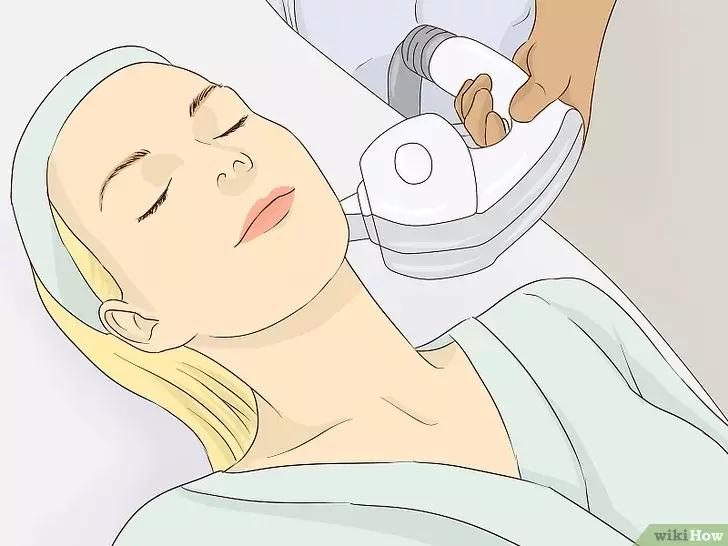 脸上笑纹怎么去除,法令纹笑纹怎么去除