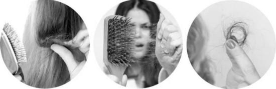 爱德兰丝与资生堂洗发水,资生堂防脱精华