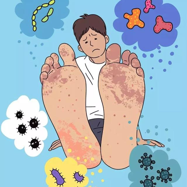 脚气如何引起,脚气病原因和防治方法