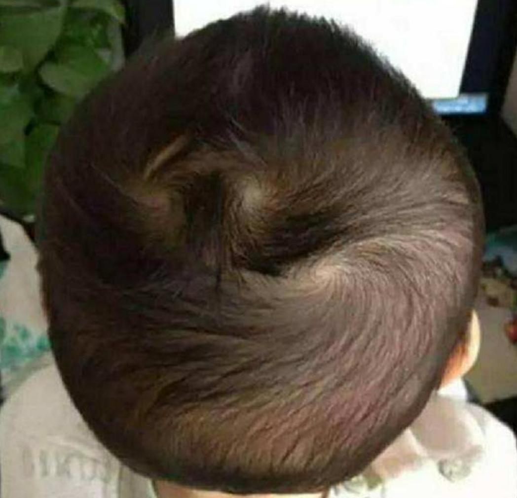 “双旋男孩找不到，双旋女孩没人要”，关于头上的旋，这几点要懂