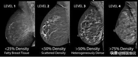 女性两癌筛查多少岁开始,女性两癌筛查多大年龄能查啊