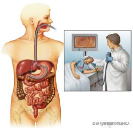 护胃健康从胃镜检查开始,做胃镜后要吃点什么护胃的药吗