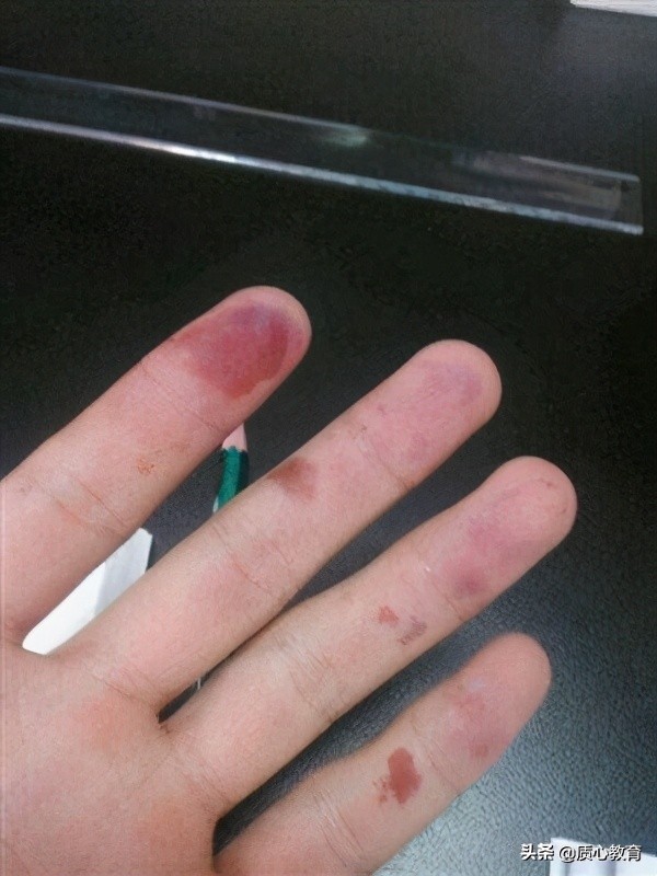 化学实验室事故案例,实验室最危险的化学物质