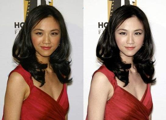 西安激光皮肤美白祛斑,激光皮秒祛斑真的有用吗