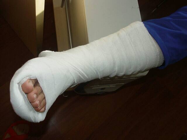 提高运动效率最佳装备,运动损伤腰带