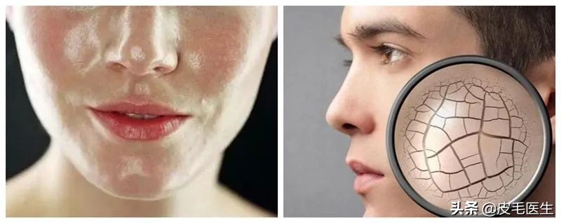 既能美白又能湿润皮肤的洗脸方法,混合性皮肤正确洗脸的方法步骤