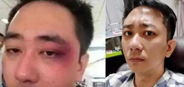 王自健为什么被家暴那么惨,王自健走出家暴完整视频