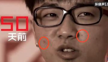 疑似华晨宇女友放锤！曝光其植发整容照，怒斥张碧晨插足当小三