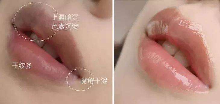 周冬雨唇形,周冬雨的脸高级吗