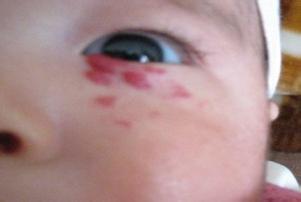 宝宝体重减轻了但不发烧,宝宝体重增加不明显