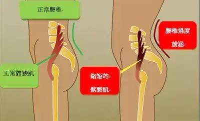 不懂健身动作练到的肌肉,锻炼髂腰肌最有效方法图解