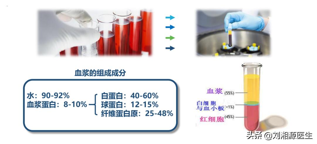 静脉丙种球蛋白怀孕用,免疫球蛋白与丙种球蛋白保胎