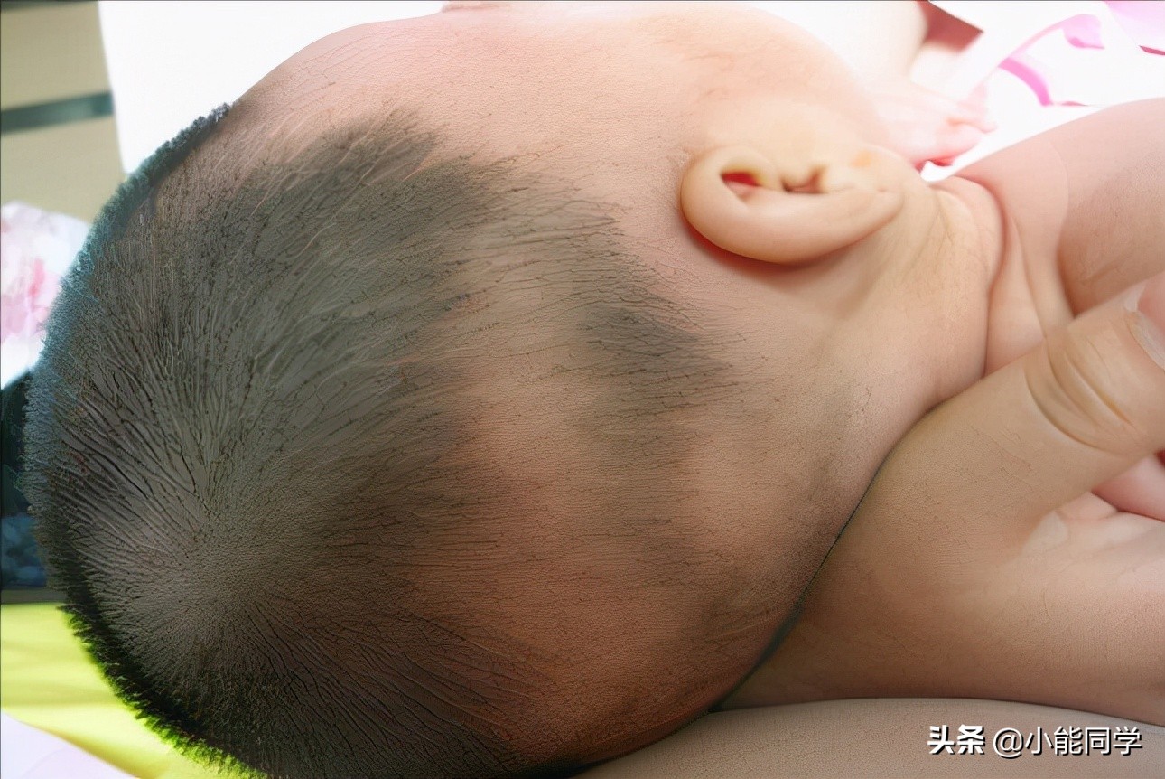 四岁孩子头发双黄是营养不良吗,宝宝头发稀黄可能并不是营养不良