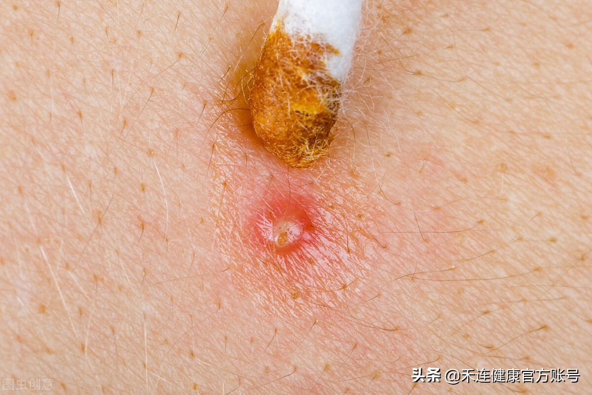 外阴难受怎么回事,外阴肿疼内阴不舒服怎么办