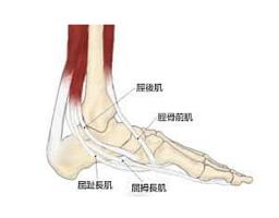 胫骨平台塌陷2-3mm的治疗方法,有足弓但是是扁平足怎么办