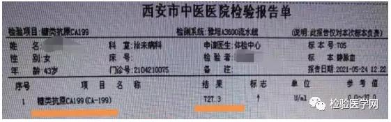 ca199一年比一年高原因,ca199前后相差20倍为什么