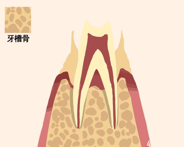 牙齿松动如何固齿,牙齿为什么会松动