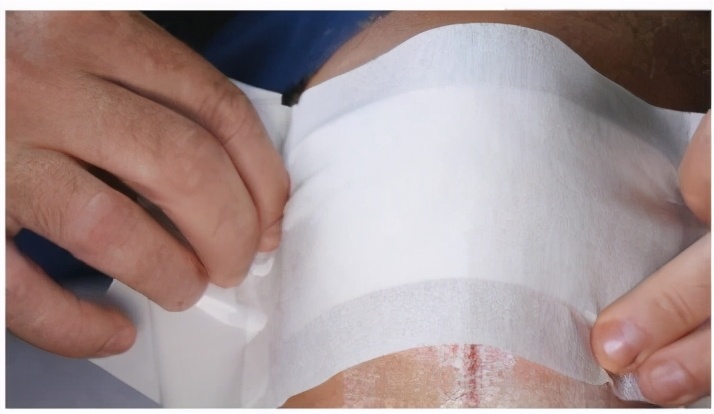 皮肤擦伤有渗出液,皮肤擦伤会留疤吗