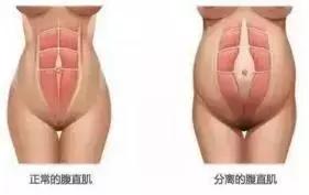 每天练一百个卷腹一个月变化,宝妈每天练卷腹