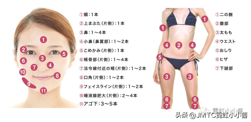 记录翻译小姐姐日本打溶脂针，肉脸变骨感脸全过程｜日本医美
