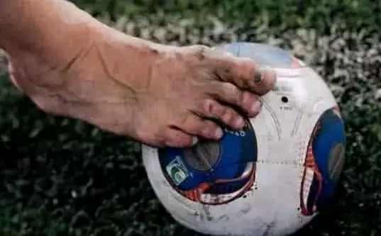 瞧瞧科比的手指，郑智的肚子，梅西C罗的脚，就会明白伟大不简单