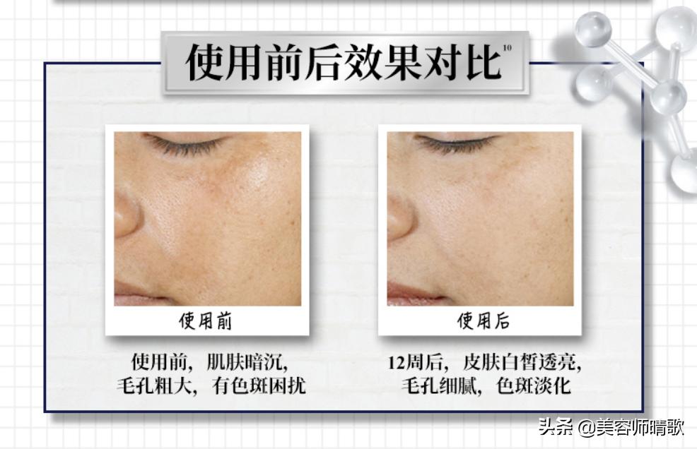 小银瓶淡斑精华推荐,美白淡斑小白瓶精华